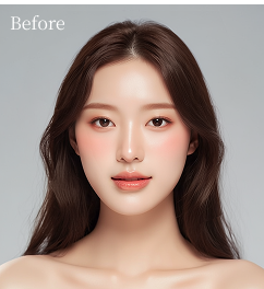 귀필러 시술 전후 비교